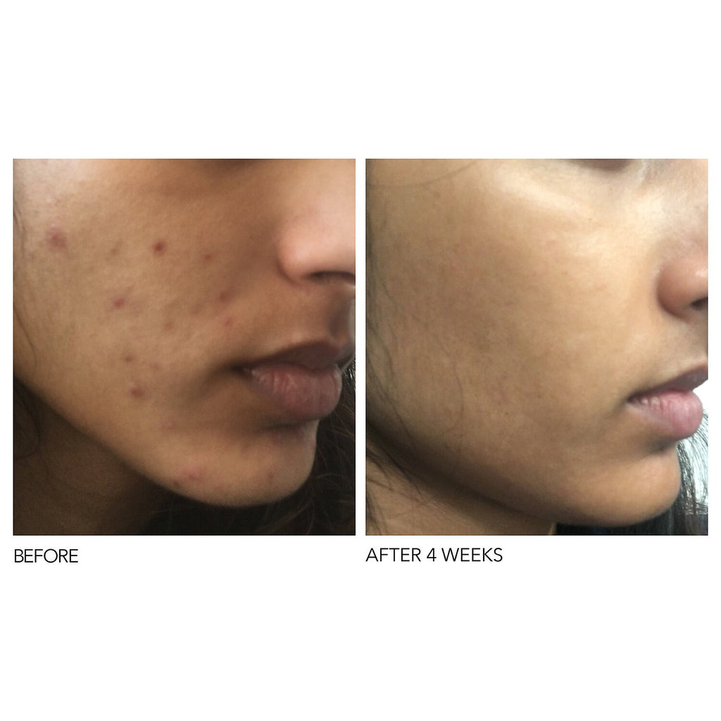 Alpha Beta® Extra Strength Daily Peel - Image 3