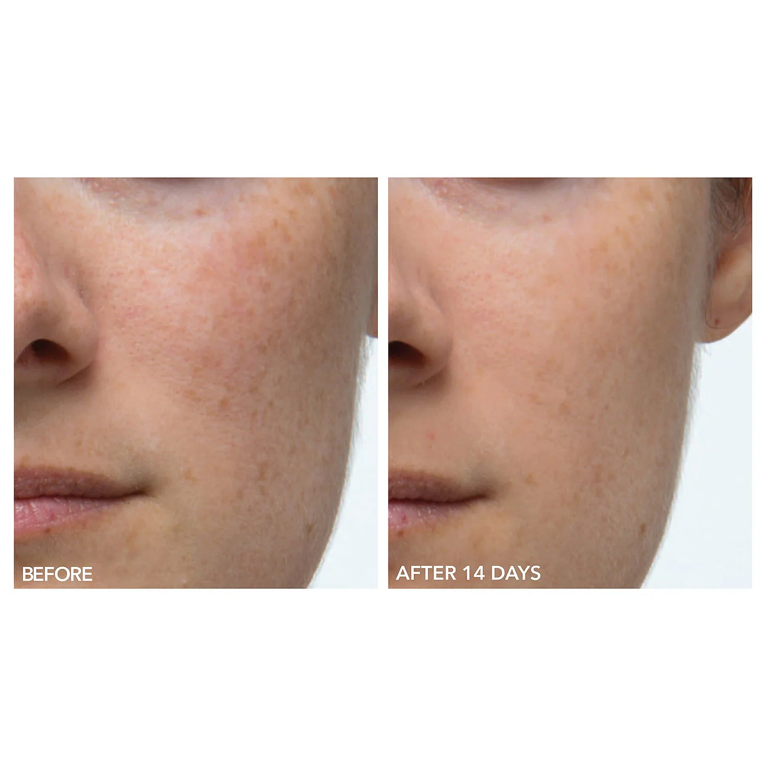 Alpha Beta® Extra Strength Daily Peel - Image 4